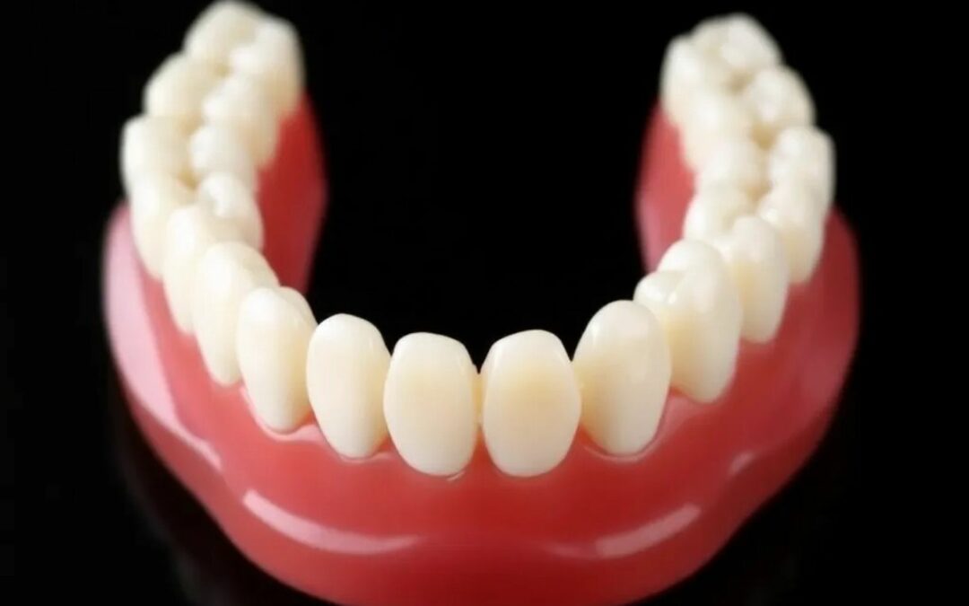 Come sono fatte le dentiere di ultima generazione